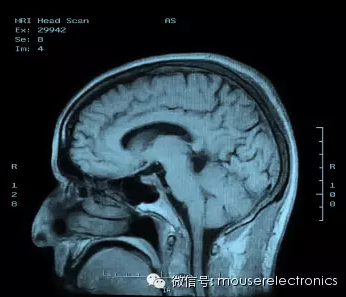 图5：MRI的大脑成像